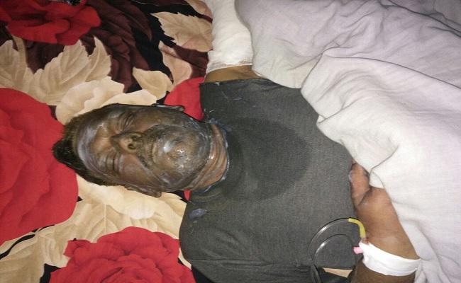 सहरसा : एसपी कार्यालय में तैनात क्लर्क सहित पत्नी आग में झुलसे, पत्नी की मौत