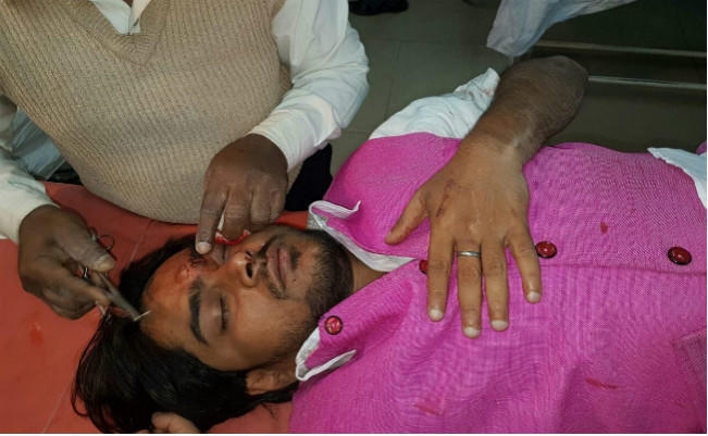 सांसद की भतीजी की शादी से लौट रहे भाजयुमो अध्यक्ष की कार व टीम पर हमला, 12 राउंड गोली चली, Photo