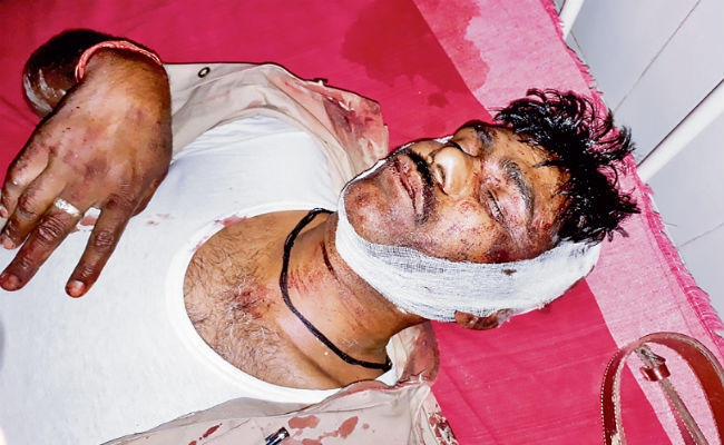 शराब माफियाओं के हमले में तीन पुलिसकर्मी घायल