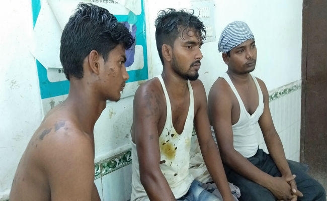 छेड़खानी के बाद दो पक्षों के लड़ाई में एसिड अटैक, आठ झुलसे