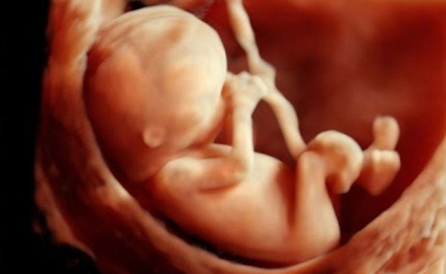समस्तीपुर : गर्भ में बच्चे की मौत, 10 घंटे तक अस्पताल में कराहती रही महिला