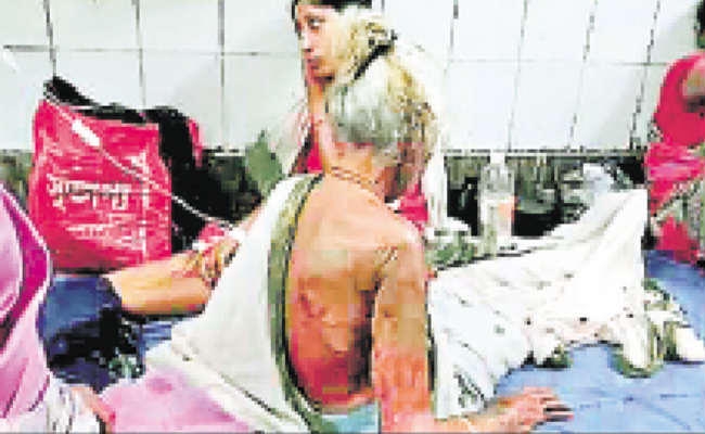 नानी-नतिनी पर एसिड से हमला, घर की खिड़की से सोये अवस्था में फेंका एसिड नहीं मिला कोई सुराग