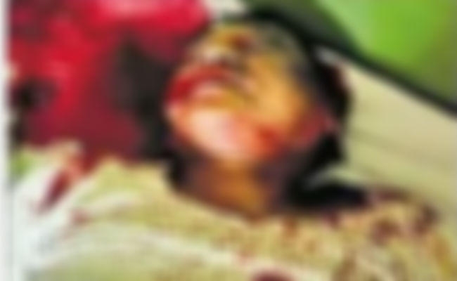 देवघर : डॉ विनोद पर घर में घुस कर हमला, कराहने की आवाज पर उठी नर्स फिर…