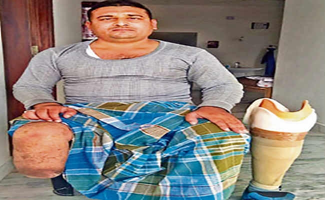 नक्सलियों के बारूदी सुरंग विस्फोट से जीवन बना नरक