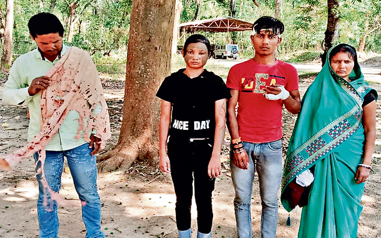 दुमका एसिड अटैक मामला : पीड़ित परिवार ने एसपी से लगायी न्याय की गुहार, छप्पर छारने के दौरान हुआ था विवाद