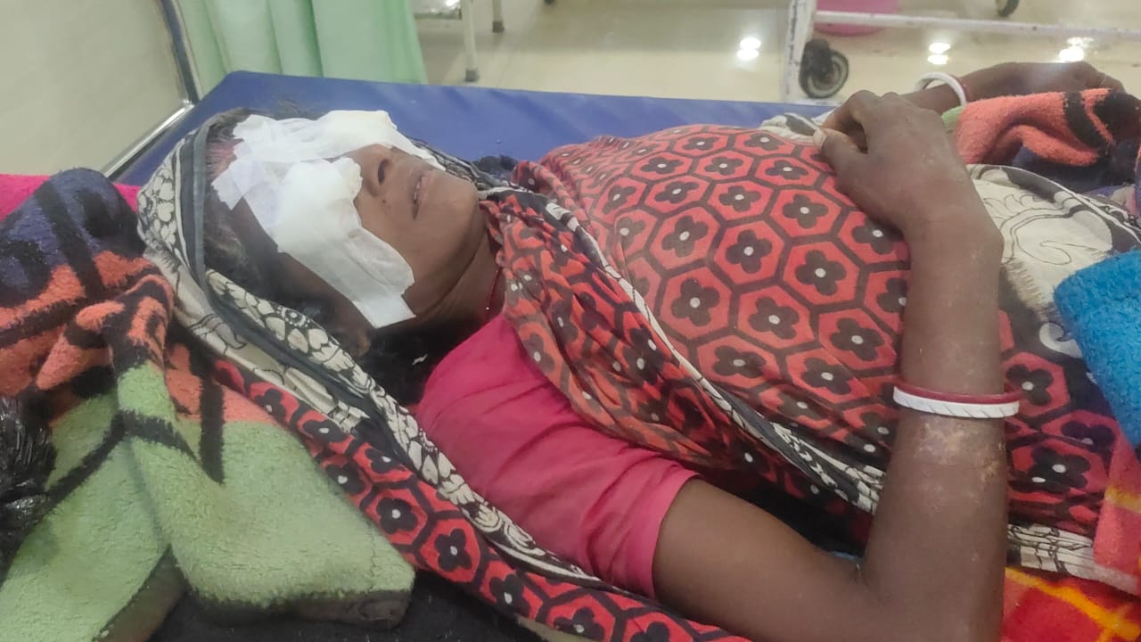 Bihar: कटिहार में सोई हुई महिला को घर से जबरन खींच कर खेत ले गया युवक, हाथ-पैर बांधकर फोड़ डाली आंख