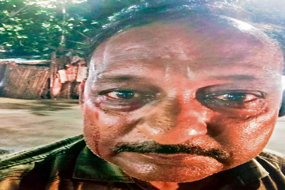 अजीबो गरीब बीमारी: आंखों से आंसू की जगह बहता है खून, डॉक्टर भी नहीं पता कर पा रहे वजह