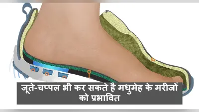 Diabetes Tips : जूते-चप्पल भी कर सकते है मधुमेह के मरीजों को प्रभावित, भूल कर भी इन Foot Wears का नहीं करें इस्तेमाल