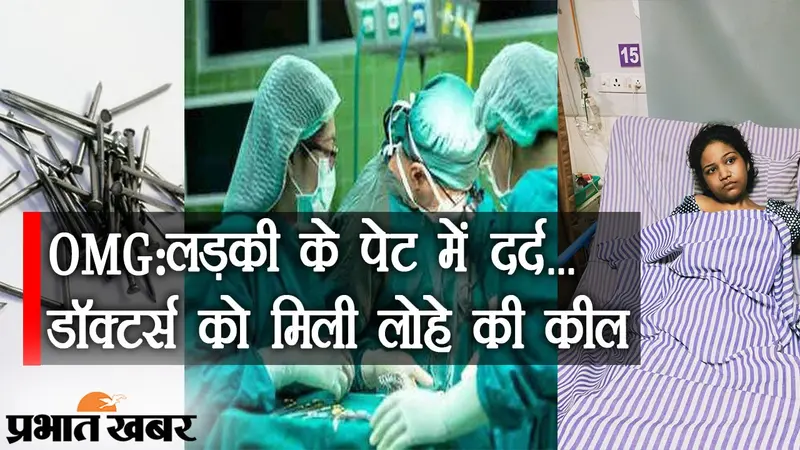VIDEO: लड़की के पेट में दर्द… सर्जरी में डॉक्टर्स को मिली लोहे की तीन कील, आखिर माजरा क्या है?