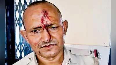 कैमूर : पुलिसवालों को दौड़ा कर पीटा एक का सिर फोड़ा, उंगली तोड़ी
