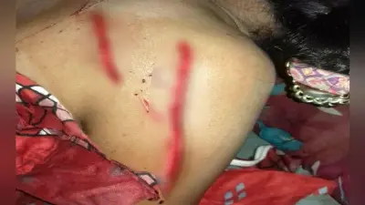इकतरफा प्यार में आशिक ने युवती पर किया चाकू से जानलेवा हमला, इंसाफ दिलाने के लिए सोशल मीडिया पर कैंपेन चला रहे युवा