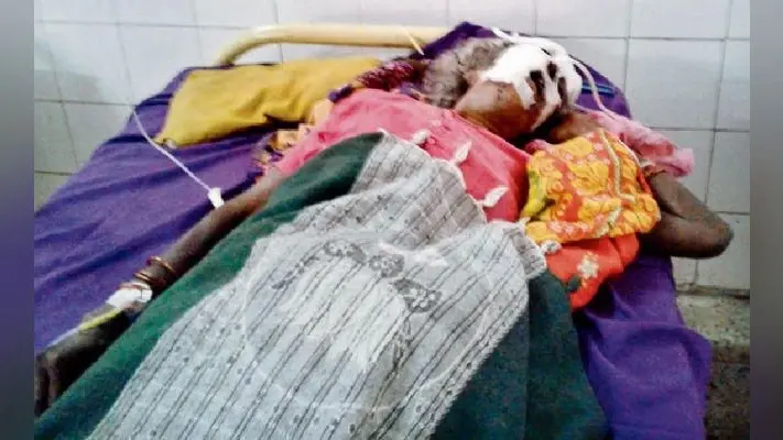 रोहतास में डायन के शक में महिला की जीभ काटी