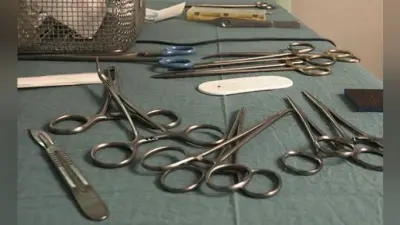 शख्स ने खायी कीलें, टूथपिक्स व शीशे, ऑपरेशन के बाद पेट से निकली 122 कीलें