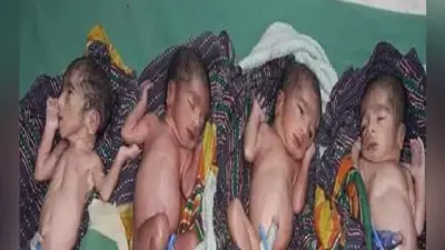 महिला ने चार बच्ची को एक साथ दिया जन्म, सभी स्वस्थ
