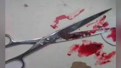 कैंची से छोटे भाई को किया जख्मी, आंखों के पास पड़े 20 टांके