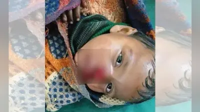 टाटीझरिया : आवारा कुत्तों का आतंक, छोटे बच्चे को बुरी तरह काटा, स्थिति गंभीर