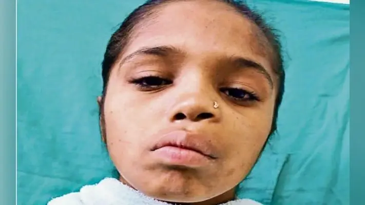 पटना : बायें जबड़े की ओर था ट्यूमर मुफ्त में आयुष्मान योजना के तहत की गयी सर्जरी