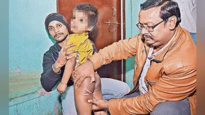 जमशेदपुर : मां छोड़ कर चली गयी, पाल रही महिला ने चार साल के बच्चे को गर्म कलछुल से दागा