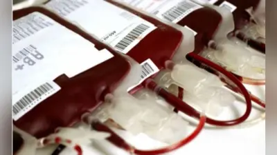 पूर्वी सिंहभूम में डेंगू से 300 फीसदी बढ़ी प्लेटलेट्स की मांग, 160 यूनिट प्रतिदिन हो रहा है उपयोग