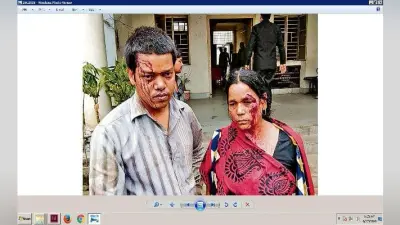नाली से पानी की निकासी को ले मारपीट, मां-बेटा घायल