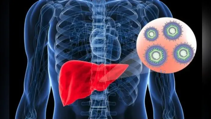 Health News: हेपेटाइटिस को हल्के में न लें, हर साल 4 लाख लोगों को निगल रहा यह संक्रमण