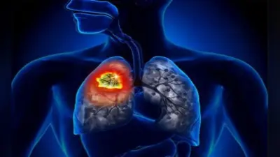 Health Research: धूम्रपान नहीं करनेवाले भी फेफड़े के कैंसर से हैं पीड़ित, जानें वजह…