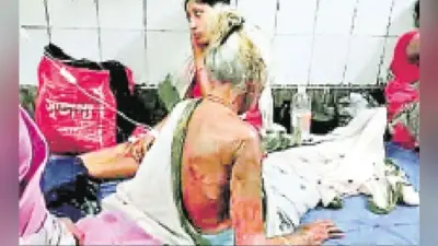नानी-नतिनी पर एसिड से हमला, घर की खिड़की से सोये अवस्था में फेंका एसिड नहीं मिला कोई सुराग