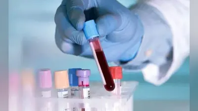 पटना : 6 से 13 सितंबर तक बंद रहेंगे पैथोलॉजी लैब