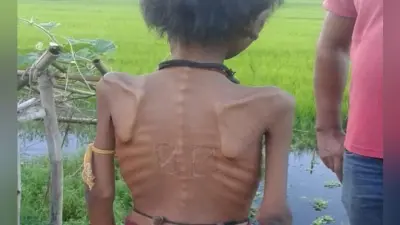कुपोषित बच्चे के इलाज को लिए मांगे 500 रुपये, तस्वीर वायरल हुई तो…