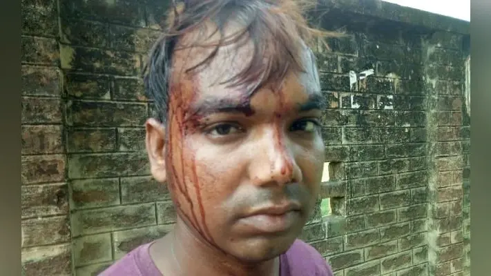 जमीन के विवाद में भतीजे पर लाठी, रॉड और ईंट से किया हमला, हुआ ये हाल