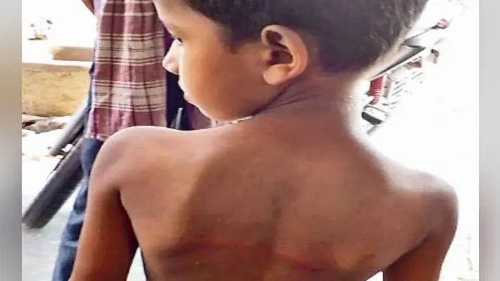 मोकामा : हाजिरी नहीं बोलने पर पहली कक्षा के छात्र को बेरहमी से पीटा