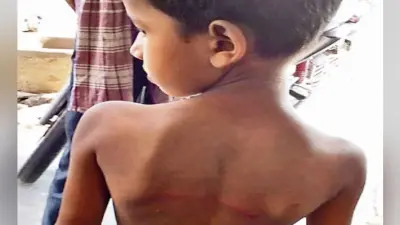 मोकामा : हाजिरी नहीं बोलने पर पहली कक्षा के छात्र को बेरहमी से पीटा