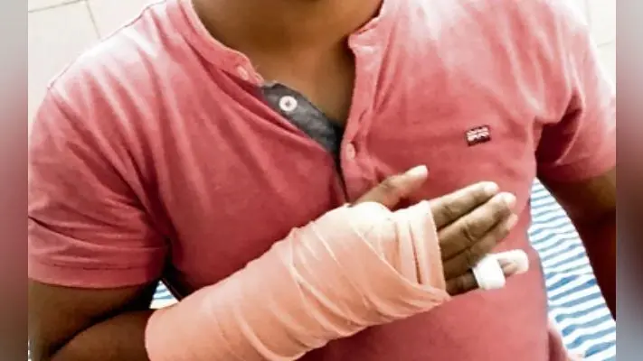 पटना : पीएमसीएच में हड़ताल खत्म, इधर फिर मारपीट, डॉक्टर के हाथ की टूटी अंगुली