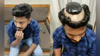 OMG! गोल्ड स्मगलिंग का इस शख्स ने निकाला ऐसा तरीका, जानकर आप भी होंगे हैरान…
