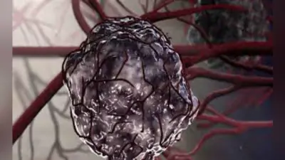 रिसर्चर्स ने आक्रामक ट्यूमर की पहचान के लिए नयी तकनीक विकसित की