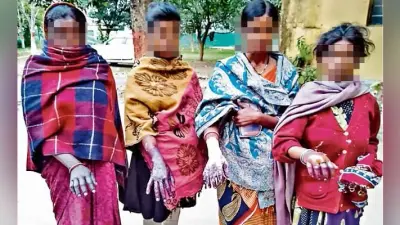 अनगड़ा : अंधविश्वास के मामले में पंचायत ने दी अनोखी सजा, गर्म पानी में हाथ डलवाये, किशोरी समेत चार महिला हुईं जख्मी