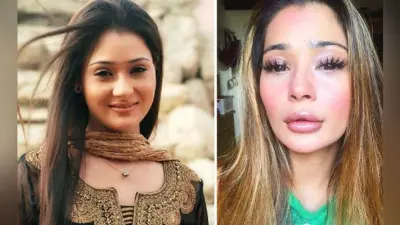सारा खान की लिप सर्जरी पर भड़के फैंस, यूजर्स बोले- आपकी सर्जरी फेल हो गई