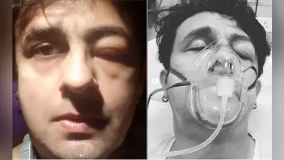 सोनू निगम को सी फूड खाने से हुई एलर्जी, ऐसी हो गई हालत
