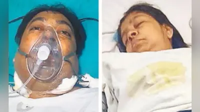पटना : आइजीआइएमएस में हुआ 50वां सफल किडनी ट्रांसप्लांट, महिला ने किडनी देकर बचायी पति की जान