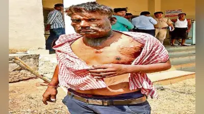 पिता ने दो बच्चों को जिंदा जलाया, एक की मौत