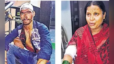 फुलवारीशरीफ : बदमाशों ने छेड़खानी का विरोध करने पर किया मां-बेटे पर चाकू से हमला