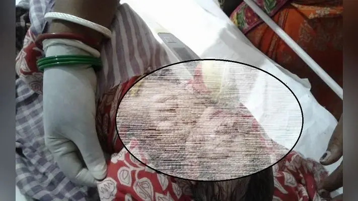 शर्मसार हुई ममता, कूड़ेदान में फेंकी मिली नवजात, नेवले बना रहे थे निवाला