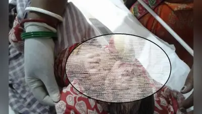 शर्मसार हुई ममता, कूड़ेदान में फेंकी मिली नवजात, नेवले बना रहे थे निवाला