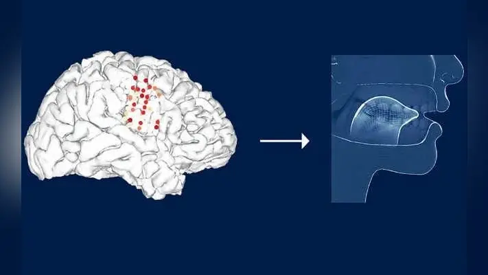 मस्तिष्क के संकेतों को ट्रांसक्रिप्ट करेगी स्पीच डिकोडर टेक्नोलॉजी