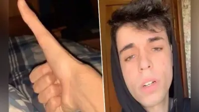 OMG! 5 इंच लंबा अंगूठा? TikTok पर Viral हुआ Video