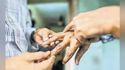 कुष्ठ रोगियों की खोज को 19 से विशेष अभियान