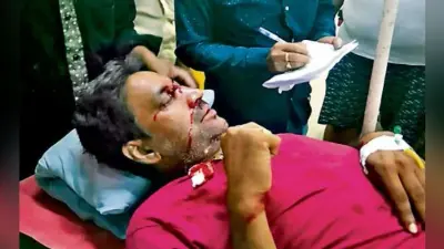लातेहार : प्रखंड कार्यालय के सामने ठेकेदार को गोली मारी