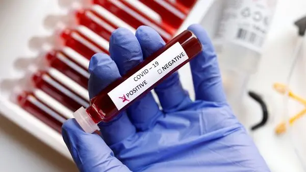 Coronavirus Outbreak: कोरोना पॉजिटिव शख्स के गांव में जांच तेज, मरीज की मौत के बाद जांच के लिए भेजा गया सैंपल