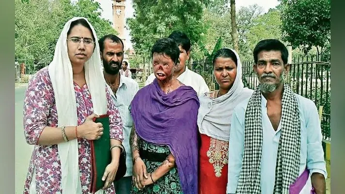 #AcidAttackSurvivor : बदलनी होगी पितृसत्तात्मक सोच, सोनी के साथ चार साल पहले हुआ ये