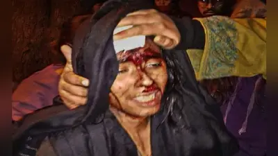 JNU Campus में छात्र संघ और एबीवीपी के बीच मारपीट में अध्यक्ष आईशी घोष बुरी तरह घायल